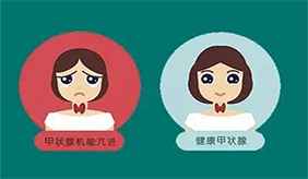 &#31435;&#21338;